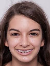 2017 California State Science Fair Participants: Elise M. Hoffman