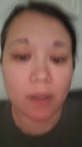 I have 2 types of asthma and the allergy one scares more people. It can hit  me any where. So I carry and inhaler