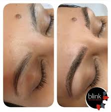 Interested in getting your eyebrow tattoos removed? Laser Tattoo Removal For Microblading And Eyebrows Xodos Aesthetics Ltd