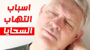 كل ما تريد معرفته عن مرض السحايا البوابة