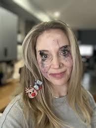 I love spending time with you guys. But, my presence is needed elsewhere.  In an attempt limit social media, I have deleted my LinkedIn app