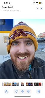 Fundraiser by Frank Bass : Help Frank Overcome Facial Neuropathy