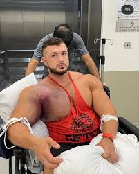 Outage history by hour (#affected Bodybuilder Ryan Crowley Just Tore His Pec Tendon Attempting 5 Plates On The Incline Bench Bodybuilding