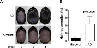 Oral hair loss treatments include natural dietary supplements such as saw palmetto and biotin as well as prescription pills like finasteride. Topical Administration Of Inos Inhibitor Potentiates Hair Regeneration Download Scientific Diagram
