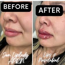 Jen Courson APRN FNP-C 👄 (@nurse___jen) • Instagram photos and videos