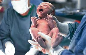 How a bishop score may determine if you'll get induced. Bishop Score Modified Bishop Score