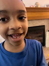 Kai lost his first tooth!🦷 he let me pull it!!😁