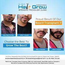 Beard Transplant Beard Transplant Low Level Laser Therapy Best Hair Loss Treatment