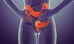 This change can be a sign of your. Colon Cancer Signs Symptoms And Complications