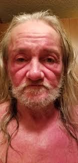 Has anyone had negative effects taking St. John's wort? Or ginseng?