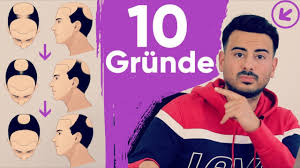 Haartransplantation stuttgart haarverpflanzung beratung eigenhaar therapie ärzte spezialisten experten kliniken. Transformation Volle Haare Ohne Haartransplantation Haarausfall By Jacob M