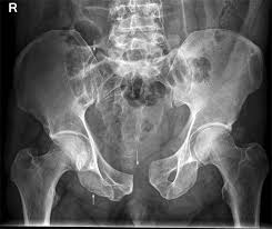 Pin En X Ray