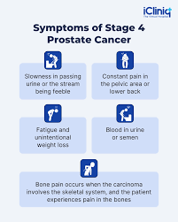 Image result for Prostate Cancer Staging