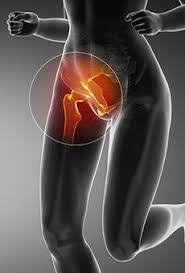 Upper leg thigh and groin pain. Chronic Groin Pain More Than Just Osteitis Pubis Newcastle Sports Medicine