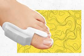 как лечить косточку на ноге в домашних условиях отзывы Kak Ubrat Kostochki Na Nogah V Domashnih Usloviyah Beauty Hub