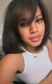 Team freckles, you're gorgeous!!!