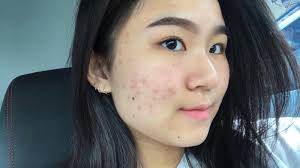 Meaning of doc medical term. First Facial Experience One Doc Medical Nourish To Flourish