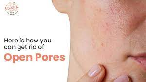 Here Is How You Can Get Rid Of Open Pores