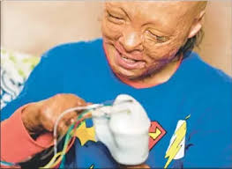 For badly burned boy, a pair of helping hands