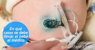 Ombligo Del Bebe Cuidados E Higiene