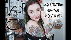 Learn more about your options for reducing pain. Why Laser Tattoo Removal Is A Better Option For Cover Ups