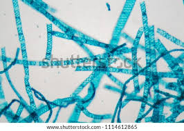 Spirogyra is a genus of green algae of the order zygnematales. Shutterstock Puzzlepix