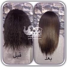 فيلر بروتين اوجا فوائده يقوي الشعر Skyline Salon صالون أفق الجمال Facebook