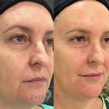 Patrícia Lucca • Estética • Tratamento capilar