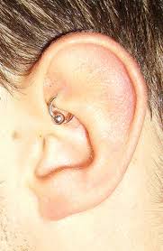 I'Ve Had These Second Lobe Piercings Since Around Easter And They'Ve Been  Like This Around A Month Now, I Clean Then Twice A Day With Boiled Water  And Pink Himalayan Salt (What