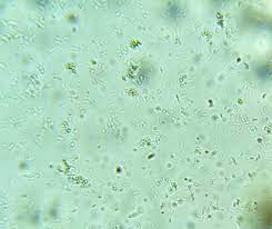 We did not find results for: Bacteria Under A Microscope Vs Disinfectant Microscope Clarity