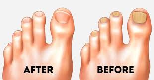 I'd also avoid flipping them on their back as they can aspirate. 10 Easy Tips To Make Your Feet Look Perfect