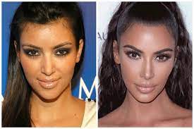 Two editors challenged themselves to eat like kim for a week, with different results all beauty, all the time—for everyone. The Big Problem With Plastic Surgeons Dissecting Kim K S Plastic Surgery