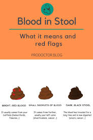Image result for Blood in stool