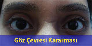 goz cevresi kararmasi ve mezoterapi