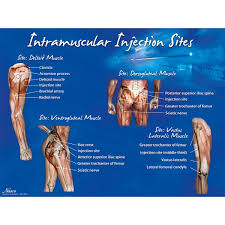 Intramuscular Injection Sites Poster 1018427 W44783 Lf00695 Injection Training Products Skills Training Products Medical Skills Training Nurse Tra Intramuscular Injection Sites Im Injection Nursing Jobs