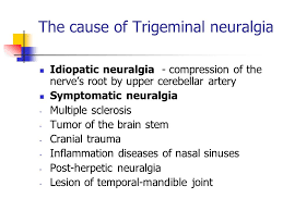 Trigeminal Neuralgia/ Facial Nerve Pain Ayurvdic Herbal Remedies in  Australia