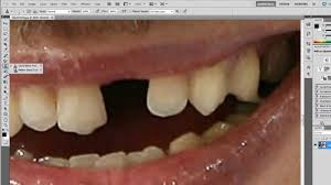 Fanatics outlet is the ultimate destination for officially licensed discount pittsburgh steelers apparel and gear. Fixing Alex Ovechkin S Teeth Photoshop Youtube