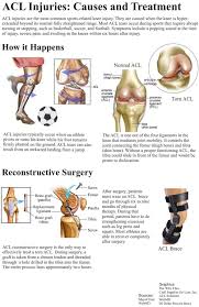 Pin By Carl Pearson On Acl Tear Knee Surgery Recovery Acl Tear Injury