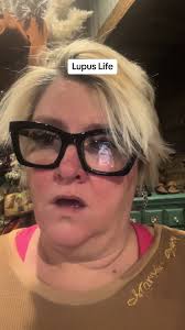 Still waiting to start Orencia. Saw my favorite dr today. He did some ...