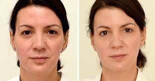 Divide this number by 16.9 to find roughly the number of 16.9 oz water bottles you should drink a day. This Woman Drank 3 Liters Of Water A Day Her Final Results Shocked Everyone Littlethings Com