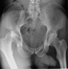 Rontgen Radiologie Und Nuklearmedizin Alb Fils Kliniken