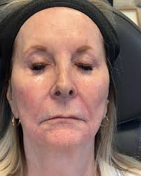 One of the things I am most passionate about is helping women age  gracefully… Helping women look their best even into their 70s and 80s… This  lovely lady has trusted me with