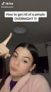 Some treatments help reduce them, but to get rid of all the comedons, you probably need a professional cleanup. Skin Tones Discover Get Rid Of A Pimple Overnight Natural Skin Care Skin Care Routine Skin