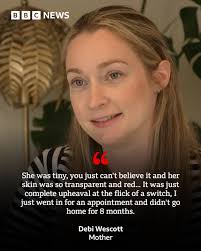 Baby Elsie developed complications with her lungs, heart and eyes when she  was born at just 23 weeks old. Now her mum and dad are backing research to  stop others going through