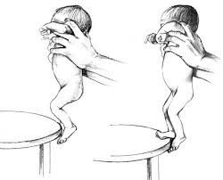 Viktor's Notes – Pediatric Neurologic Examination