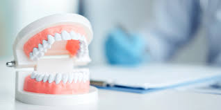 Unsere dienstleistungen im bereich zahnimplantate. Diese Kosten Ubernimmt Ihre Krankenkasse Bei Zahnersatz Ikk Classic