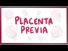 Pictures of spotting during pregnancy 3rd trimester. 9 Reasons For Bleeding And Spotting During Pregnancy