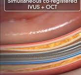 Optical Coherence Tomography (OCT) | DAIC