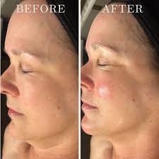 Business Networking in Austin