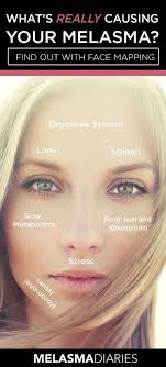 Melasma is a skin condition characterised by dark spots and patches on the nose, cheeks and jawline. Pin On Natural Medicine Remedies